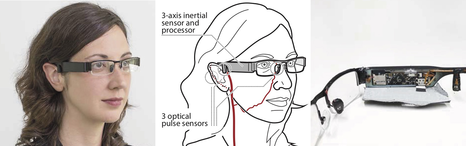 2017-imwut17-glabella-figure1.jpg